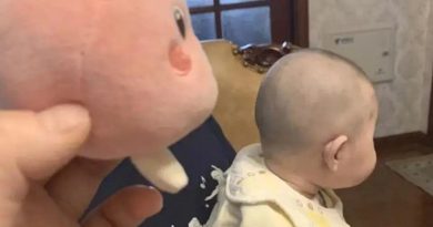 Bác sĩ chỉ ra cách giúp bé có đầu tròn đúng chuẩn