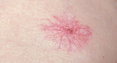 Bệnh gan có thể biểu hiện trên khuôn mặt, làn da? Bác sĩ chỉ rõ 5 dấu hiệu cho thấy sức khỏe gan đang báo động