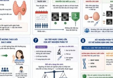 Những điểm mới quan trọng về quản lý bướu nhân tuyến giáp