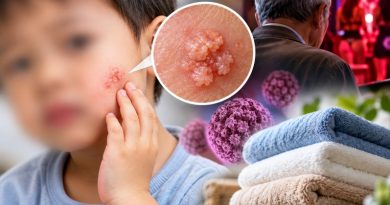 Bé 3 tuổi xuất hiện tổn thương giống mào gà trên mặt, bác sĩ cảnh báo nguồn lây bất ngờ: Lỗi của ông nội